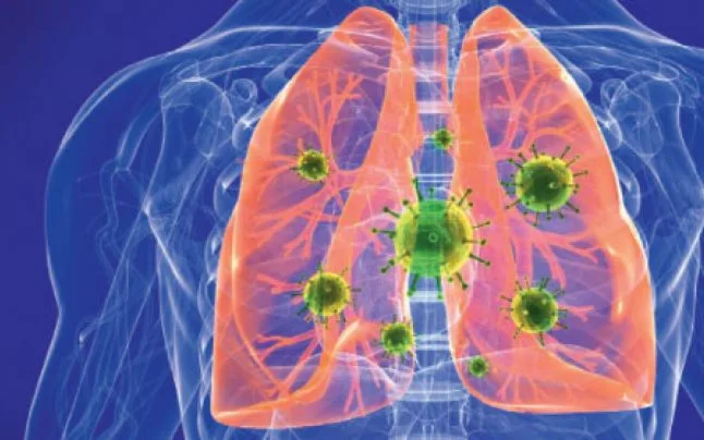 Un pacient japonez este suspect de pneumonie virală care afectează în prezent China