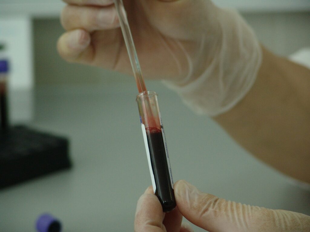 blood-20745_1920-1