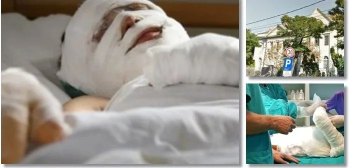 clinica-recuperare-arsi