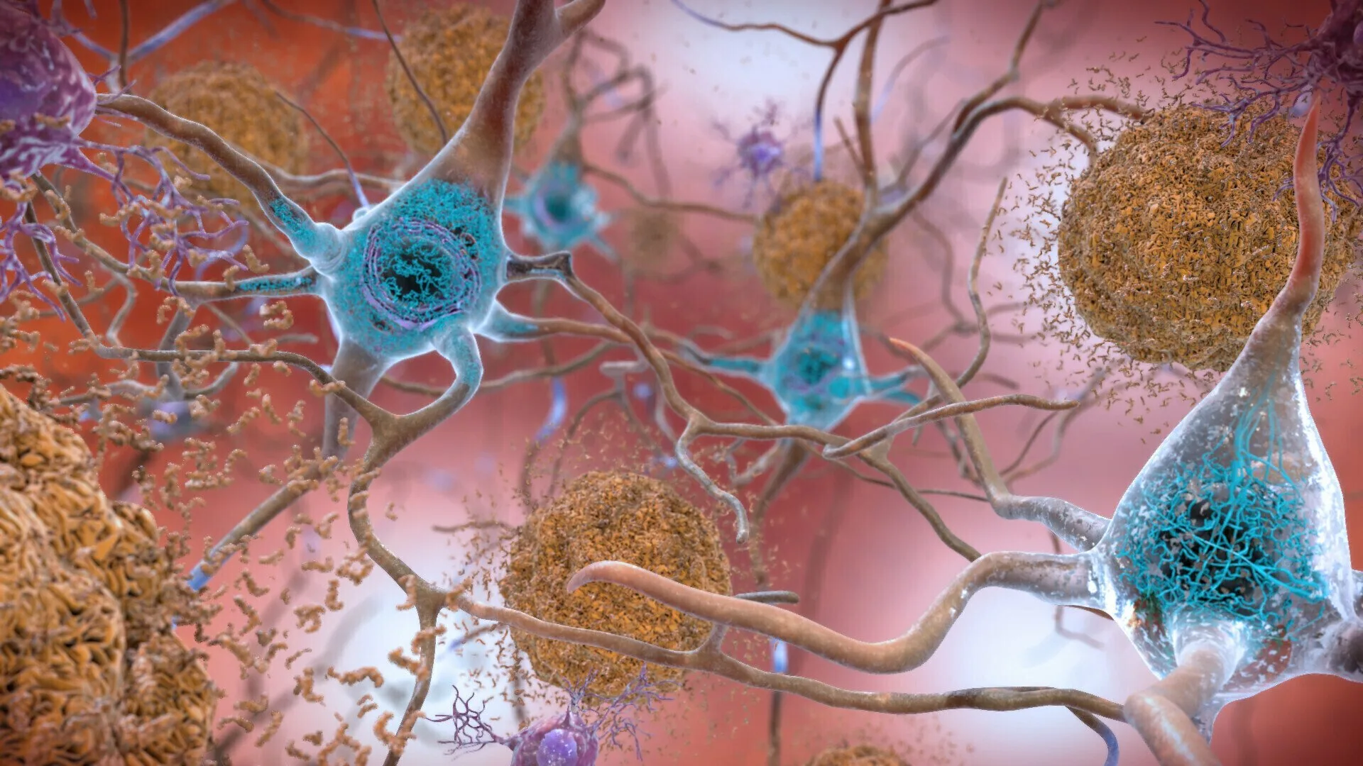 Sysmex spune că Japonia aprobă trusa de test de sânge cu marker pentru Alzheimer |  Știri despre sănătate