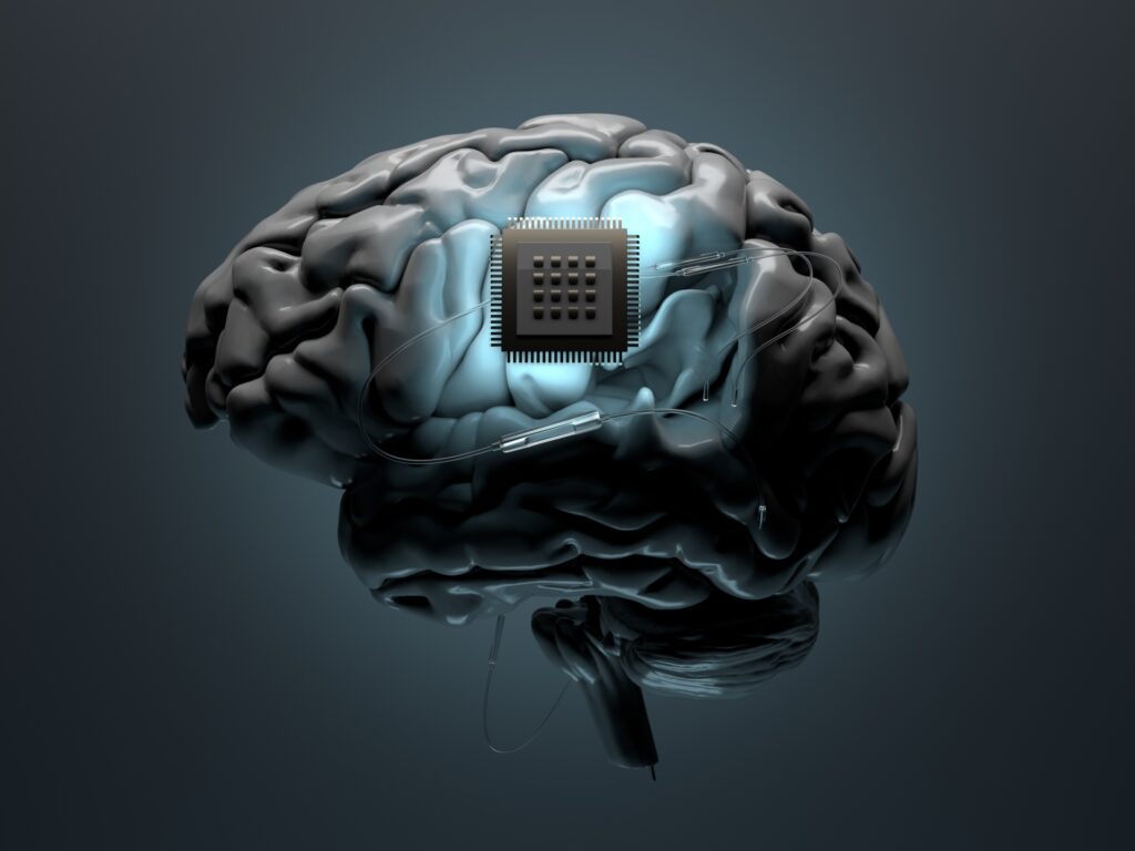 Ce ne rezervă viitorul pentru tehnologia implanturilor cerebrale? | seriale
