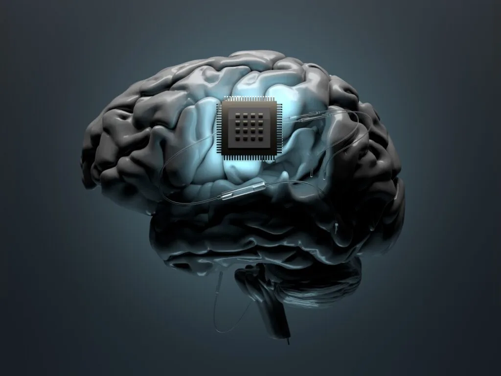 Ce ne rezervă viitorul pentru tehnologia implanturilor cerebrale? | seriale