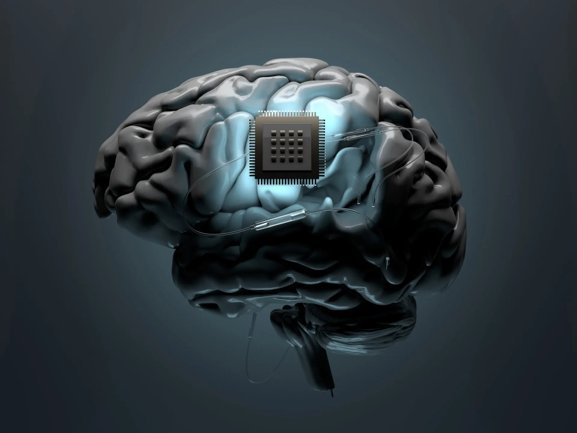 Ce ne rezervă viitorul pentru tehnologia implanturilor cerebrale?  |  seriale TV