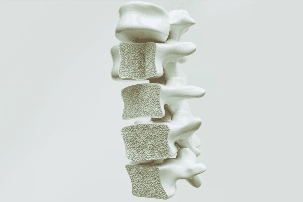 Hernia de disc: cauze, simptome și opțiuni de tratament