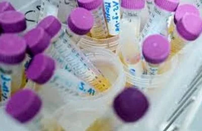 Panica pe litoral – Creme de soare cu substanta cancerigena! Zeci de produse, suspecte