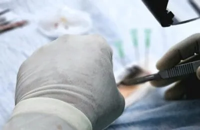 Premiera medicală – Transplant facial revoluționar – 100 de medici în Spania