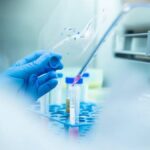 ATENȚIE! Icterul la persoanele peste 58 de ani poate fi un semn al cancerului pancreatic